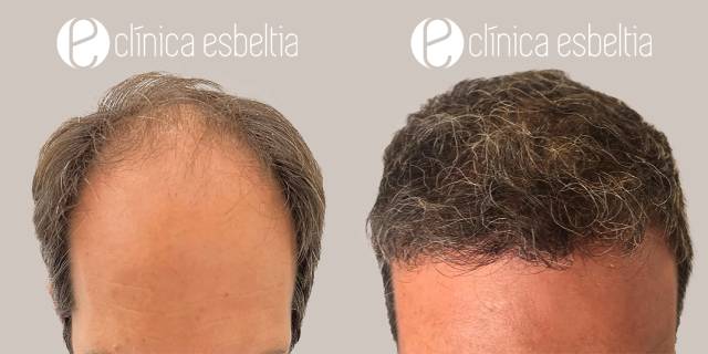 Clinica Esbeltia