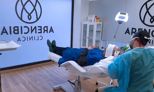 Clínica Arencibia - Trasplante capilar